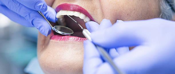 Best Dental Abscess Treatment in USA